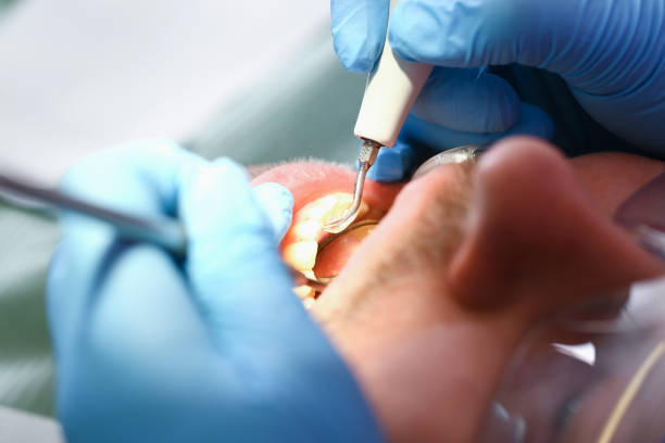 Best Emergency Dentist for Lost Fillings or Crowns in Hudson Oaks, TX