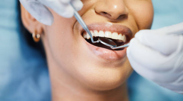 Best Emergency Dental Extractions in Hudson Oaks, TX