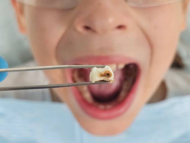Best Weekend Emergency Dentist in Hudson Oaks, TX